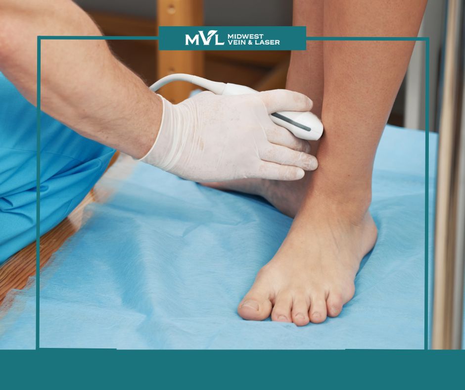 vein Screening post Midwest Vein and Laser 2